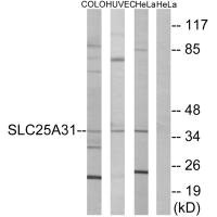 Western blot analysis of extracts from COLO cells, HUVEC cells and HeLa cells, using SLC25A31 antibody. Western blot analysis of extracts from COLO cells, HUVEC cells and HeLa cells, using SLC25A31 antibody.