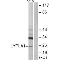 Western blot analysis of extracts from COLO cells, using LYPLA1 antibody. Western blot analysis of extracts from COLO cells, using LYPLA1 antibody.