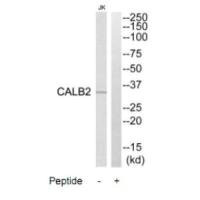 Western blot analysis of extracts from Jurkat cells, using CALB2 antibody. Western blot analysis of extracts from Jurkat cells, using CALB2 antibody.