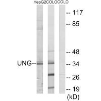 Western blot analysis of extracts from HepG2 cells and COLO cells, using UNG antibody. Western blot analysis of extracts from HepG2 cells and COLO cells, using UNG antibody.