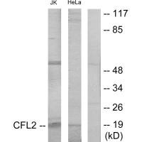 Western blot analysis of extracts from Jurkat cells and HeLa cells, using Cofilin antibody. Western blot analysis of extracts from Jurkat cells and HeLa cells, using Cofilin antibody.