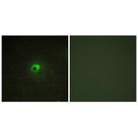Immunofluorescence analysis of COS-7 cells, using ACTR-1C antibody.