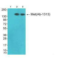 Western blot analysis of extracts from JK cells (Lane 2) and K562 cells (Lane 3), using Met (Ab-1313) antiobdy. The lane on the left is treated with synthesized peptide. Western blot analysis of extracts from JK cells (Lane 2) and K562 cells (Lane 3), using Met (Ab-1313) antiobdy. The lane on the left is treated with synthesized peptide.