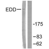 Western blot analysis of extracts from A549 cells, using EDD antibody.