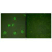 Immunofluorescence analysis of HeLa cells, treated with PMA (125ng/ml, 30mins), using Cullin 1 antibody.