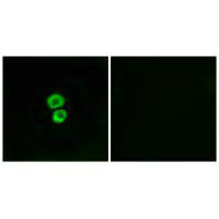 Immunofluorescence analysis of MCF-7 cells, using IFM3 antibody.