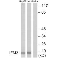 Western blot analysis of extracts from HepG2 cells and HeLa cells, using IFM3 antibody. Western blot analysis of extracts from HepG2 cells and HeLa cells, using IFM3 antibody.
