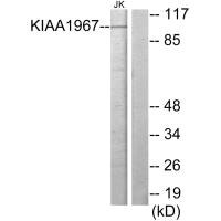 Western blot analysis of extracts from Jurkat cells, using KIAA1967 antibody. Western blot analysis of extracts from Jurkat cells, using KIAA1967 antibody.