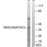 Western blot analysis of extracts from Jurkat cells, treated with serum (20%, 15mins), using MAP2K3 (Ab-222) antibody. Western blot analysis of extracts from Jurkat cells, treated with serum (20%, 15mins), using MAP2K3 (Ab-222) antibody.