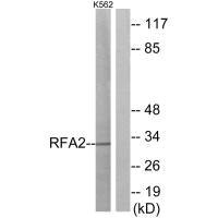 Western blot analysis of extracts from K562 cells, using RFA2 (Ab-21) antibody. Western blot analysis of extracts from K562 cells, using RFA2 (Ab-21) antibody.