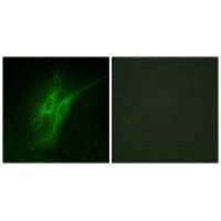 Immunofluorescence analysis of HeLa cells, using 5-HT-4 antibody.