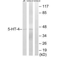 Western blot analysis of extracts from JK and colo cells, using 5-HT-4 antibody. Western blot analysis of extracts from JK and colo cells, using 5-HT-4 antibody.