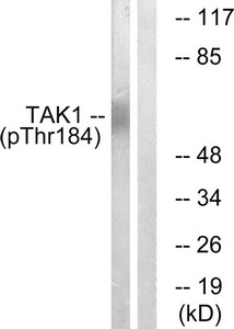 Western blot analysis of extracts from HepG2 cells, treated with TNF (20ng/ml, 5mins), using TAK1 (Phospho-Thr184) antibody. The lane on the right is treated with the synthesized peptide.