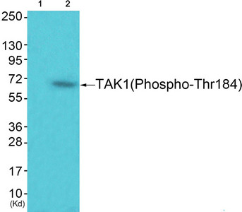 Western blot analysis of extracts from 293 cells (Lane 2), using TAK1 (Phospho-Thr184) Antibody. The lane on the left is treated with synthesized peptide.