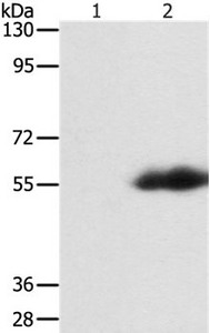 Gel: 8%SDS-PAGE Lysate:40ug 293T cells transfected with DYKDDDDK-tagged protein vectorPrimary antibody: 1/500 dilution Secondary antibody dilution: 1/8000 Exposure time: 30 seconds Gel: 8%SDS-PAGE Lysate:40ug 293T cells transfected with DYKDDDDK-tagged protein vectorPrimary antibody: 1/500 dilution Secondary antibody dilution: 1/8000 Exposure time: 30 seconds