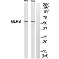Western blot analysis of extracts from A549 cells and K562 cells, using GLRB antibody. Western blot analysis of extracts from A549 cells and K562 cells, using GLRB antibody.