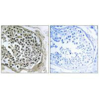 Immunohistochemistry analysis of paraffin-embedded human tesophagusis tissue using GIDRP88 antibody.