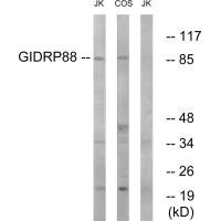 Western blot analysis of extracts from Jurkat cells and COS cells, using GIDRP88 antibody. Western blot analysis of extracts from Jurkat cells and COS cells, using GIDRP88 antibody.