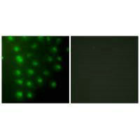 Immunofluorescence analysis of HUVEC cells, using AKAP8 antibody.