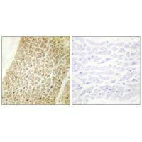 Immunohistochemistry analysis of paraffin-embedded human heart tissue using AKAP8 antibody.