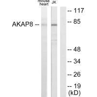 Western blot analysis of extracts from mouse heart cells and Jurkat cells, using AKAP8 antibody. Western blot analysis of extracts from mouse heart cells and Jurkat cells, using AKAP8 antibody.