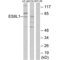 Western blot analysis of extracts from COLO205 cells, using ES8L1 antibody. Western blot analysis of extracts from COLO205 cells, using ES8L1 antibody.