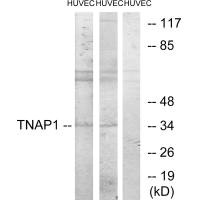 Western blot analysis of extracts from HUVEC cells treated with PMA (125ng/ml, 30mins), and HUVEC cells treated with serum (20%, 30mins), using TNAP1 antibody. Western blot analysis of extracts from HUVEC cells treated with PMA (125ng/ml, 30mins), and HUVEC cells treated with serum (20%, 30mins), using TNAP1 antibody.
