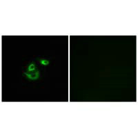 Immunofluorescence analysis of A549 cells, using CLCC1 antibody.