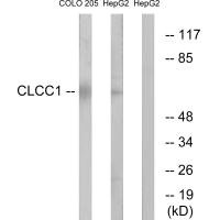Western blot analysis of extracts from COLO cells and HepG2 cells, using CLCC1 antibody. Western blot analysis of extracts from COLO cells and HepG2 cells, using CLCC1 antibody.