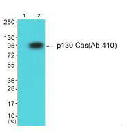 Western blot analysis of extracts from HuvEc cells using p130 Cas (Ab-410) antibody. The lane on the left is treated with synthesized peptide.