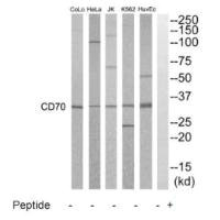 Western blot analysis of extracts from HuvEC, K562, HepG2, Jurkat, HeLa and COLO205 cells, using CD70 antibody. Western blot analysis of extracts from HuvEC, K562, HepG2, Jurkat, HeLa and COLO205 cells, using CD70 antibody.