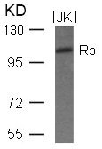Western blot analysis of extracts from JK cells using Rb(Ab-780) Antibody. Western blot analysis of extracts from JK cells using Rb(Ab-780) Antibody.