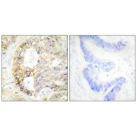 Immunohistochemistry analysis of paraffin-embedded human colon carcinoma tissue using COX41 antibody.