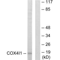 Western blot analysis of extracts from A549 cells, using COX41 antibody. Western blot analysis of extracts from A549 cells, using COX41 antibody.