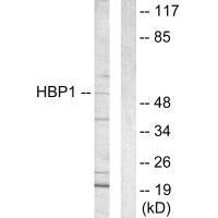 Western blot analysis of extracts from COS-7 cells, using HBP1 antibody. Western blot analysis of extracts from COS-7 cells, using HBP1 antibody.