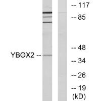 Western blot analysis of extracts from COLO205 cells, using YBOX2 antibody. Western blot analysis of extracts from COLO205 cells, using YBOX2 antibody.