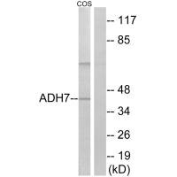 Western blot analysis of extracts from COS cells, using ADH7 antibody. Western blot analysis of extracts from COS cells, using ADH7 antibody.