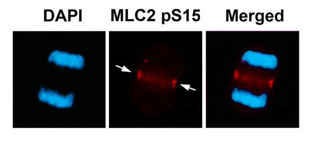 Immunofluorescence staining of methanol-fixed U87 cells using MLC2 (Phospho-Ser15) Antibody. Immunofluorescence staining of methanol-fixed U87 cells using MLC2 (Phospho-Ser15) Antibody.