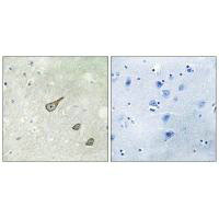 Immunohistochemistry analysis of paraffin-embedded human brain tissue, using DGKK antibody. Immunohistochemistry analysis of paraffin-embedded human brain tissue, using DGKK antibody.