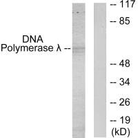 Western blot analysis of extracts from 293 cells, using DNA Polymerase ^I>> antibody. Western blot analysis of extracts from 293 cells, using DNA Polymerase ^I>> antibody.