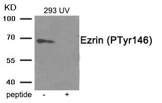 Western blot analysis of extracts from 293 cells treated with UV using Phospho-Ezrin (Tyr146) antibody.The lane on the right is treated with the antigen-specific peptide. Western blot analysis of extracts from 293 cells treated with UV using Phospho-Ezrin (Tyr146) antibody.The lane on the right is treated with the antigen-specific peptide.