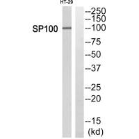 Western blot analysis of extracts from HT29 cells, using SP100 antibody. Western blot analysis of extracts from HT29 cells, using SP100 antibody.