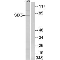 Western blot analysis of extracts from K562 cells, using SIX5 antibody. Western blot analysis of extracts from K562 cells, using SIX5 antibody.