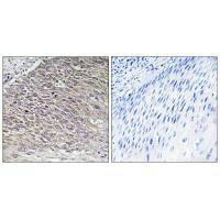 Immunohistochemistry analysis of paraffin-embedded human testis tissue using MAST4 antibody.