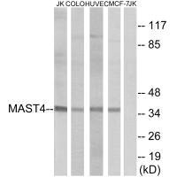 Western blot analysis of extracts from Jurkat cells, COLO cells, HUVEC cells and MCF-7 cells, using MAST4 antibody. Western blot analysis of extracts from Jurkat cells, COLO cells, HUVEC cells and MCF-7 cells, using MAST4 antibody.