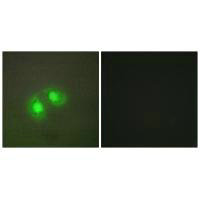 Immunofluorescence analysis of A549 cells, using TOP2A antibody.