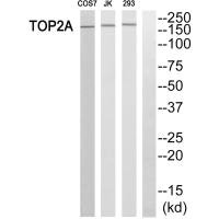 Western blot analysis of extracts from HT-29 cells, using TOP2A antibody. Western blot analysis of extracts from HT-29 cells, using TOP2A antibody.