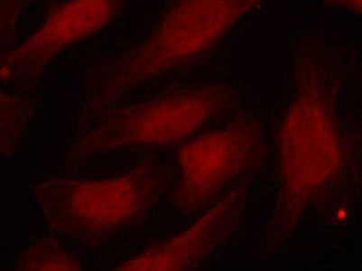 Immunofluorescence staining of methanol-fixed Hela cells using Histone H2A.X(Phospho-Ser139) Antibody.