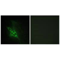 Immunofluorescence analysis of NIH/3T3 cells, using EPHB1/2/3 antibody.