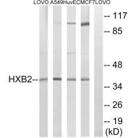 Western blot analysis of extracts from LOVO cells, A549 cells, HUVEC cells and MCF-7 cells, using HOXB2 antibody. Western blot analysis of extracts from LOVO cells, A549 cells, HUVEC cells and MCF-7 cells, using HOXB2 antibody.